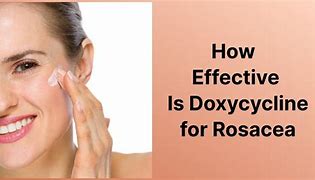 What Conditions Does Doxycycline Treat?